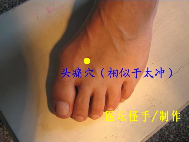 點擊將在新窗口查看全圖 王文遠平衡針灸穴位圖(6-+9) - 3396815 - 3396815博愛